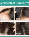 Rosemary Black Rice Water Hair Growth System Kit - Shampoo, Conditioner and Leave-in Serum