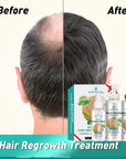 Rosemary Rice Water Hair Growth System Kit - Shampoo, Conditioner and Leave-in Serum