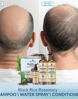 Rosemary Black Rice Water Hair Growth System Kit - Shampoo, Conditioner and Leave-in Serum