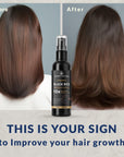 Natural Black Rice Water Hair Growth Spray For Women and Men with Castor Oil Ginger