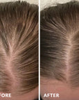 Natural Black Rice Water Hair Growth Spray For Women and Men with Castor Oil Ginger