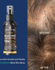 Natural Black Rice Water Hair Growth Spray For Women and Men  with Castor Oil Ginger